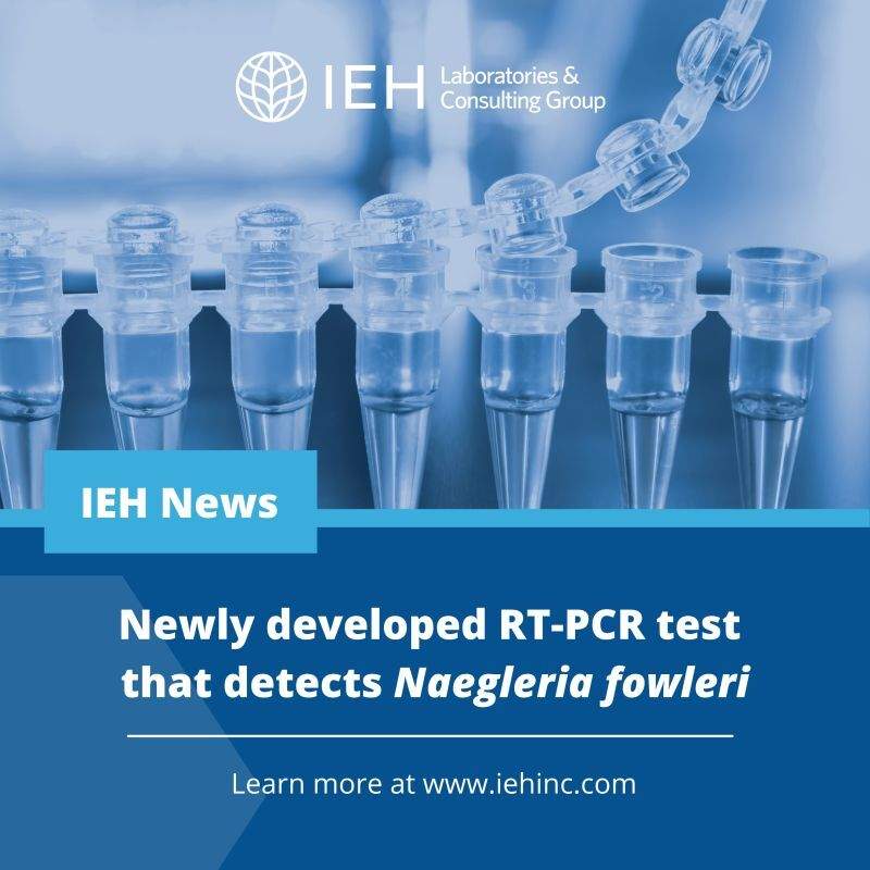 IEH announces a new RT-PCR test to detect Naegleria fowleri