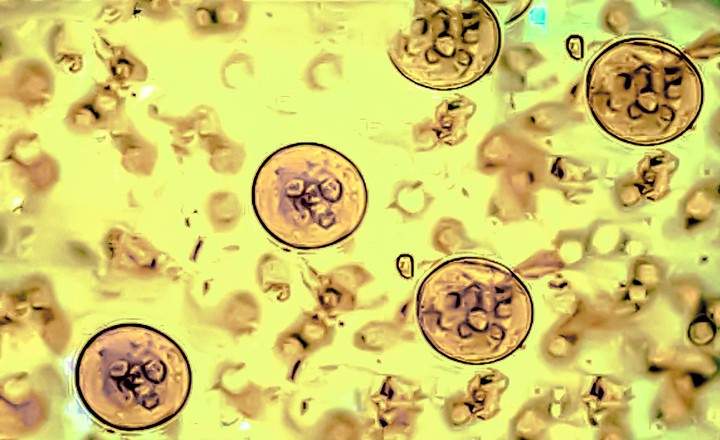A microscopic view showing several circular, oocyte-like structures scattered across a textured yellow background. These round organisms have defined outer membranes and contain internal granular features. Numerous smaller, irregular shapes and shadows are dispersed throughout the surrounding field, creating a high-contrast, slightly grainy scientific appearance.